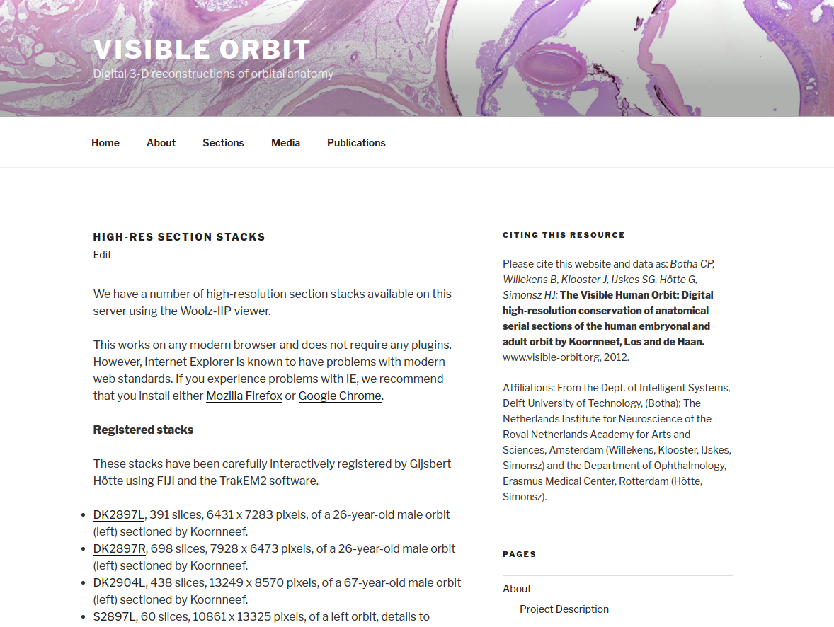 Adding page sidebar to WordPress Twenty Seventeen theme. vxlabs